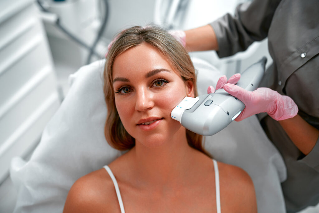 Photofacial Ipl