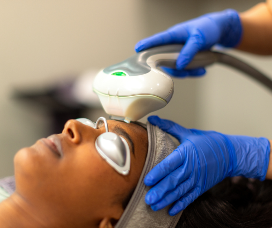 Photofacial (IPL)