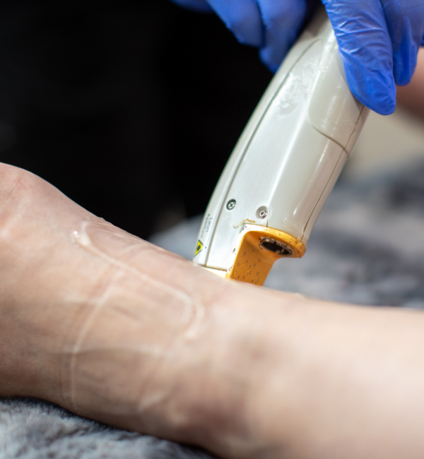 Vein Removal (1st Image__services_ page)
